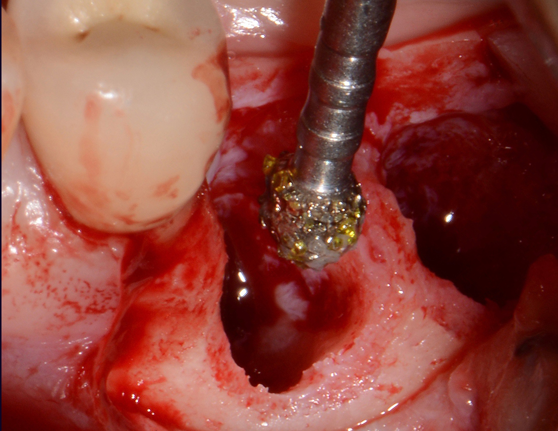 Degranulation Kit – Bild 13