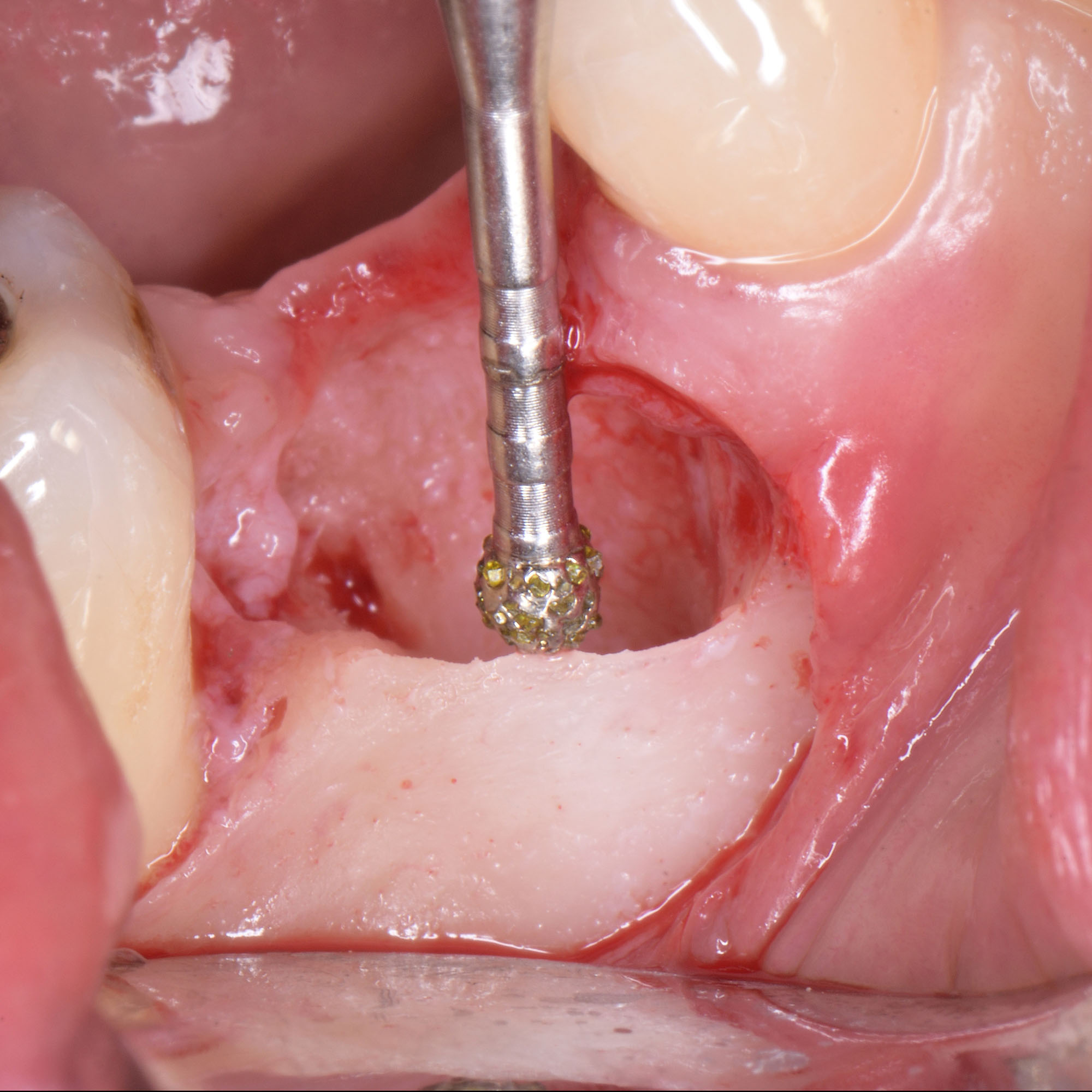 Degranulation Kit – Bild 10