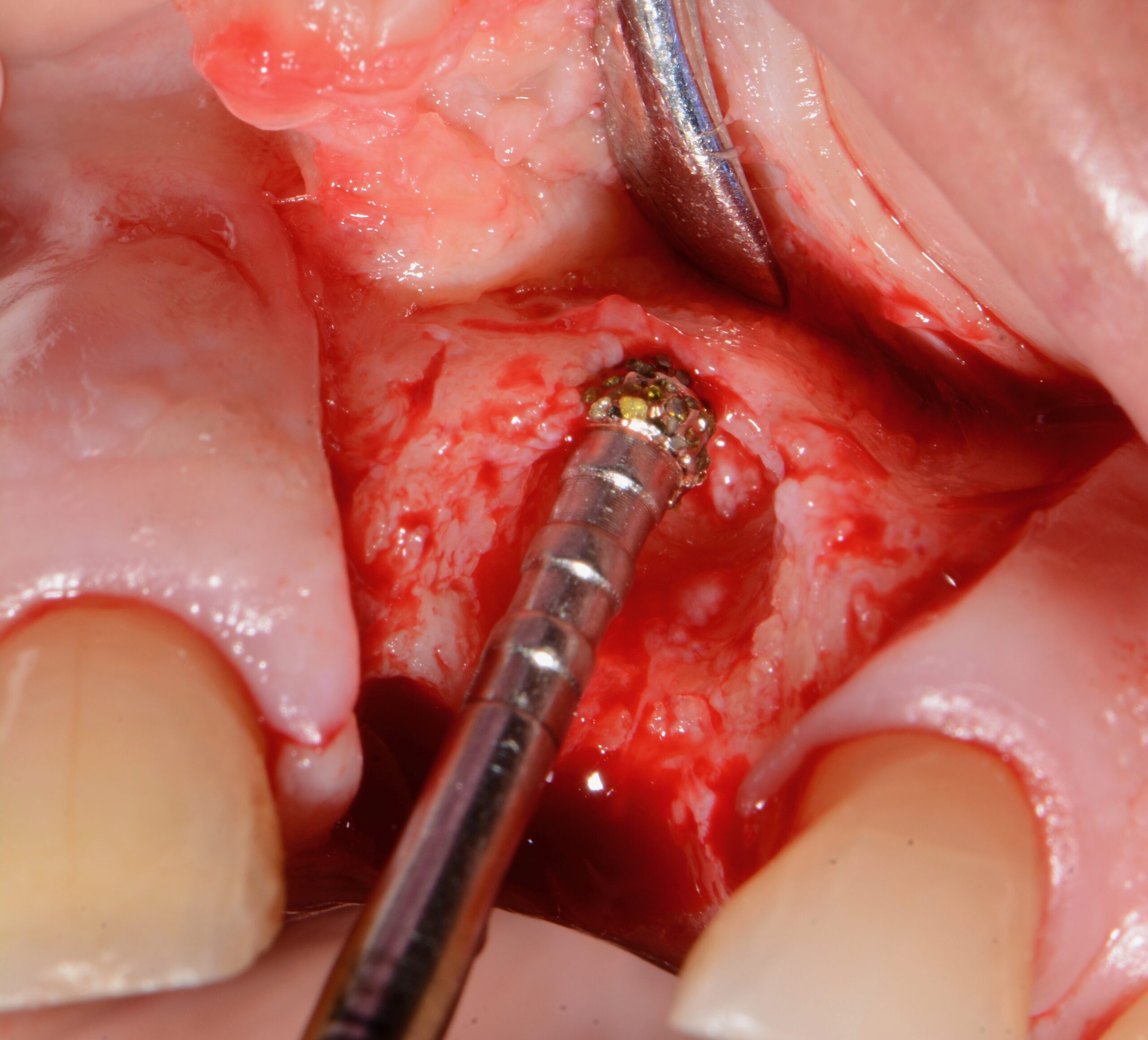 Degranulation Kit – Bild 11