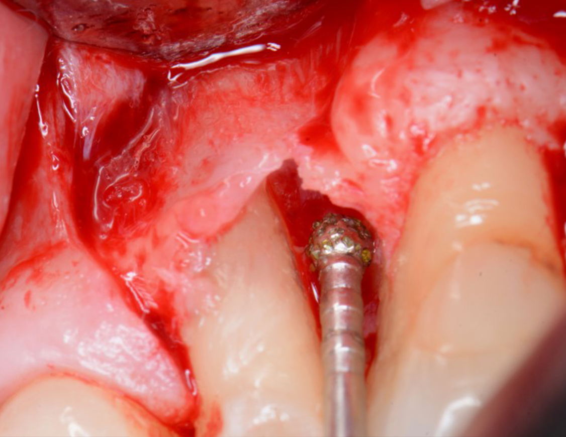 Degranulation Kit – Bild 12