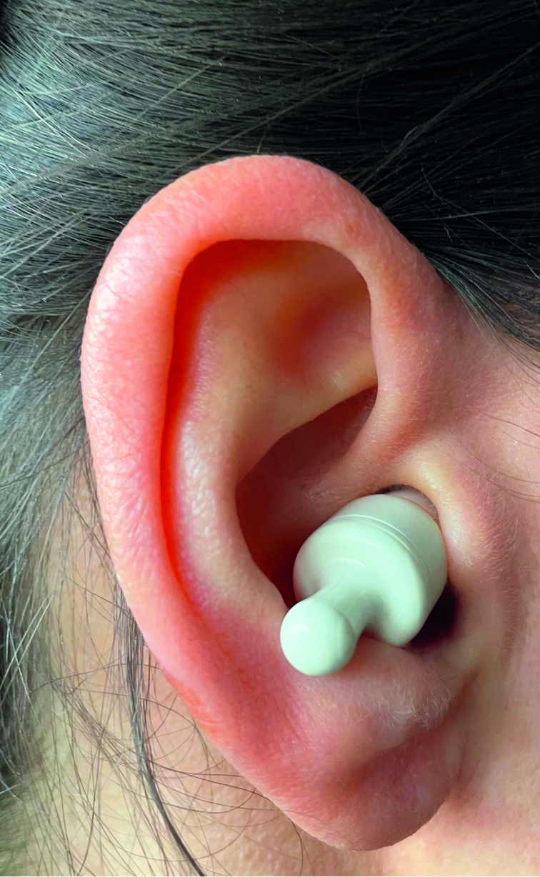 Magic Sonic, Turbinengeräusch unterdrücken – Bild 2