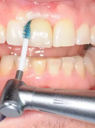 Labrida BioClean Chitosan Bürste